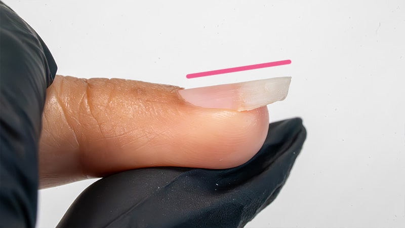 Typologie des ongles