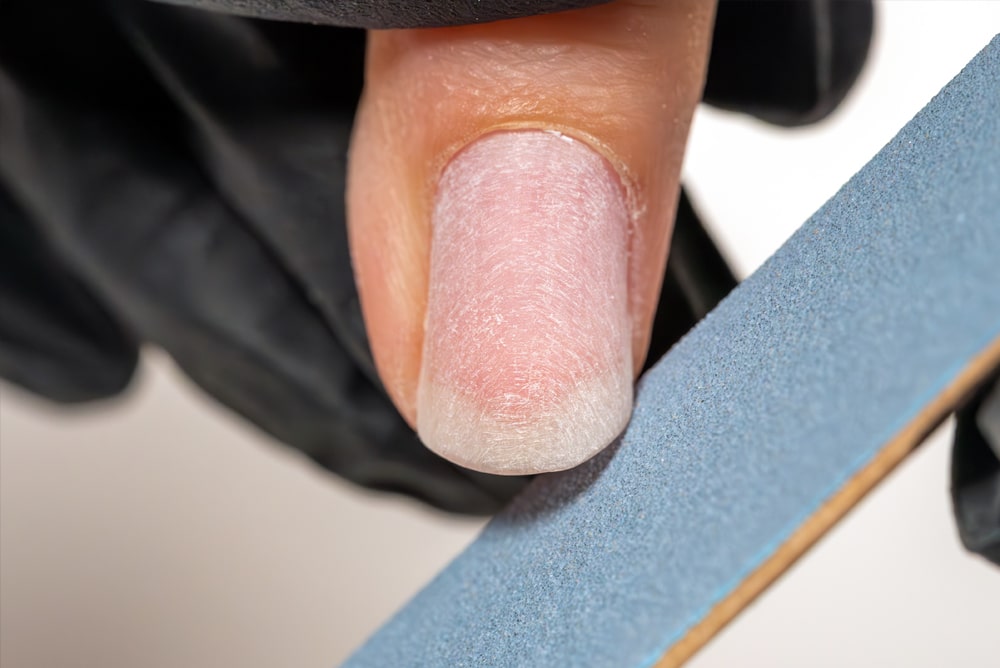 Limage de l'ongle naturel