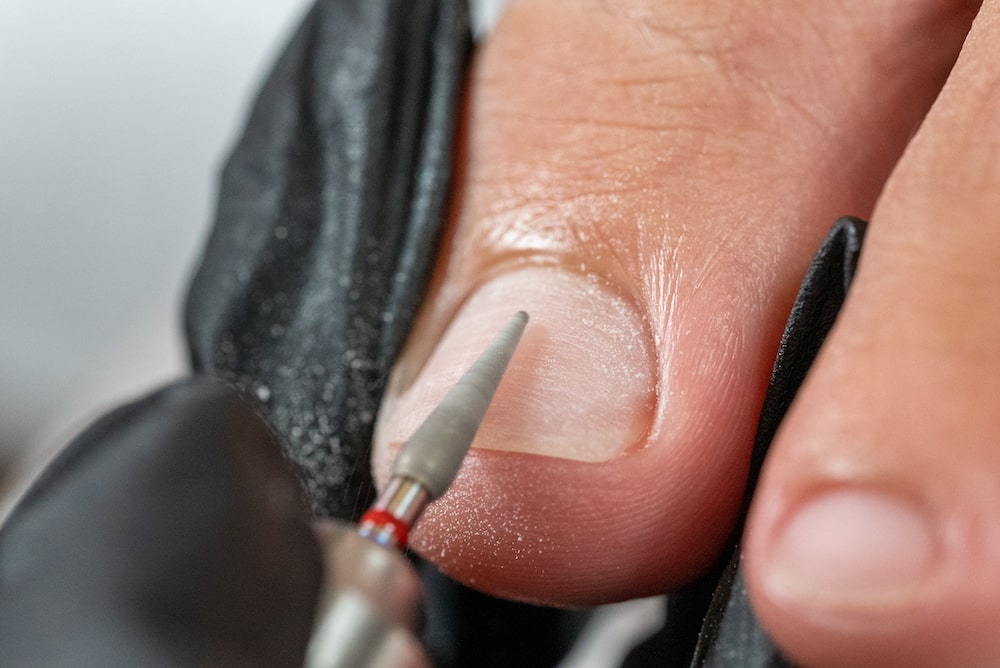 Préparation de l'ongle